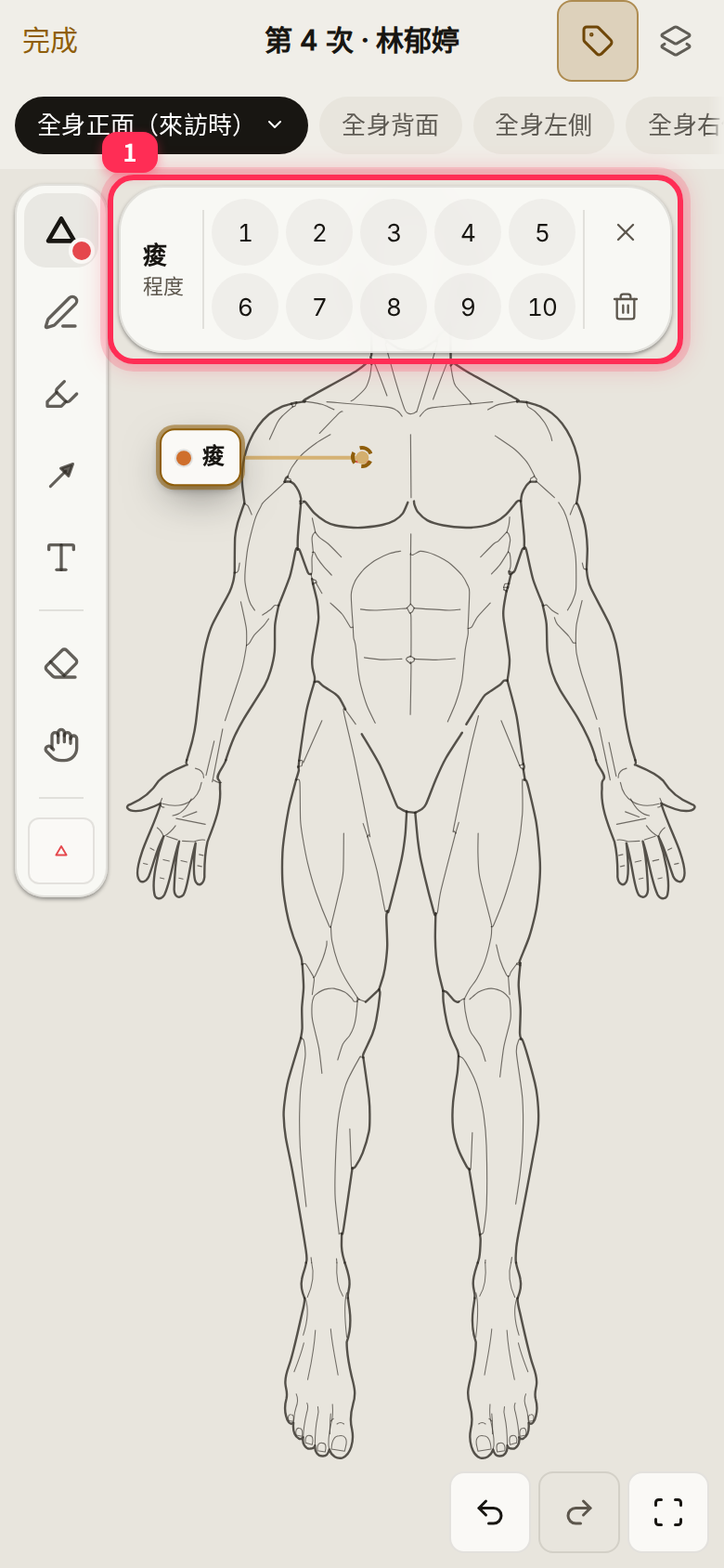 The 1–10 rating picker that appears after placing an aching symbol on the right front chest