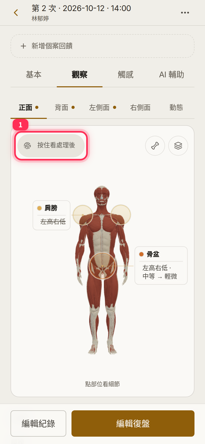 The 「按住看處理後」 (Hold for after) control at the top left of the body figure in a saved session’s Observations tab
